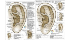 Chinese System of Ear Acupuncture Chart