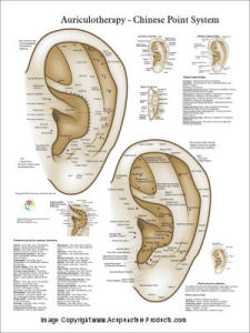 Chinese System of Ear Acupuncture Poster Chinese System of Ear Acupuncture Poster