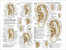 Auriculotherapy Poster
