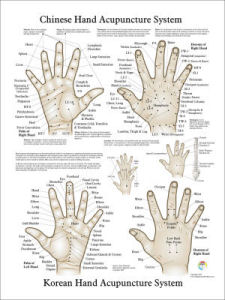Chinese Hand Acupuncture Poster Chinese Hand Acupuncture Poster