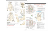 Acupuncture Treatment of Headaches Chart