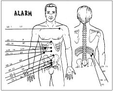 Body Alarm Points