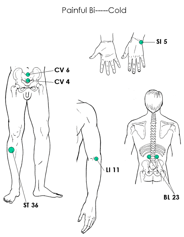 Painful Bi-Cold