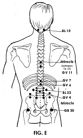 Lumbar Acupuncture Points