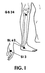 Acupuncture Lumbar Spine