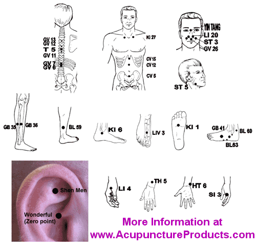 Treatment of chronic pain with acupuncture